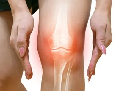 قرص استئوفلکس برای سلامت مفاصل و استخوانها